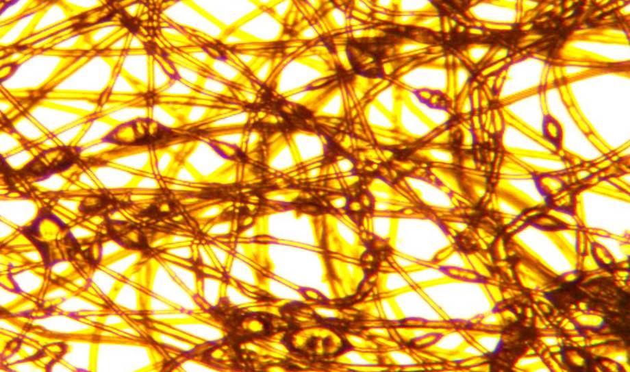 Фото под микроскопом волокна с латексом.